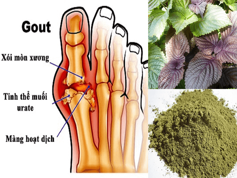 Cây thuốc chữa bệnh gout đơn giản cho hiệu quả bất ngờ | Tía Tô Akina